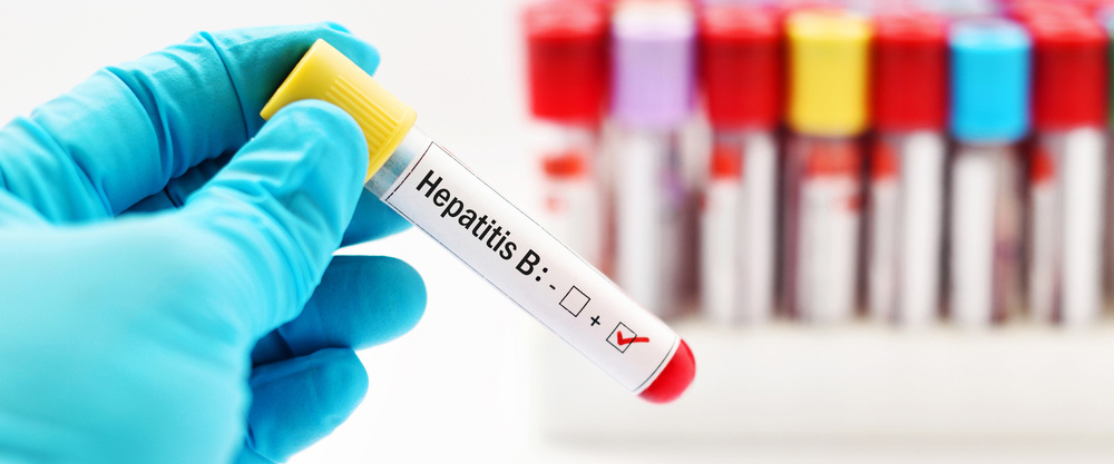 Hvad er hepatitis B? Hvad er symptomerne og behandlingsmetoderne?